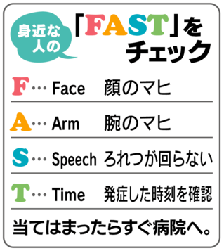 脳卒中の前兆に気が付くキーワード FAST