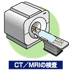 ＣＴ/ＭＲＩの検査