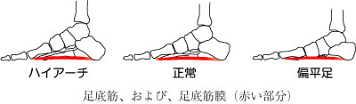 知って得する身体の話 第2回 扁平足と足底筋膜炎 シューズに感謝 鶴巻温泉病院 神奈川県