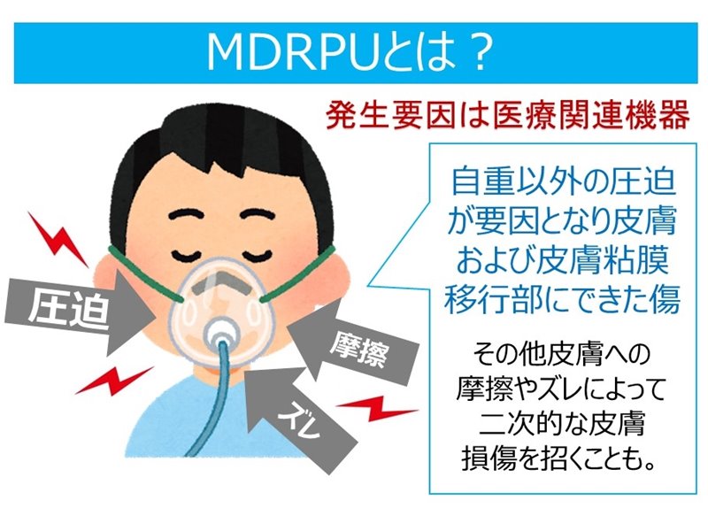 MDRPUとは